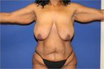ARM LIFT CASE 92
