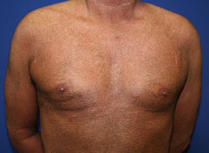 Everything You Ever Thought You Needed to Know About Men's Nipples