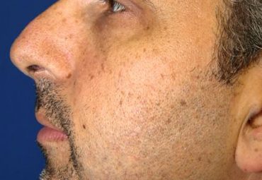 NEW PATIENTS RECEIVE 10% OFF BOTOX AND FILLERS!