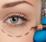 Let's Talk About Blepharoplasty, Baby.