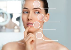 “F” IS FOR FEBRUARY AND ALSO FACIAL IMPLANTS!