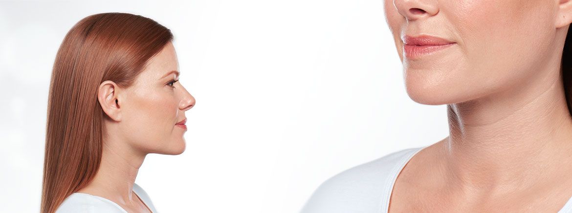 WHATSUP WITH SURGICAL VS. NON-SURGICAL NECK PROCEDURES LIKE KYBELLA?