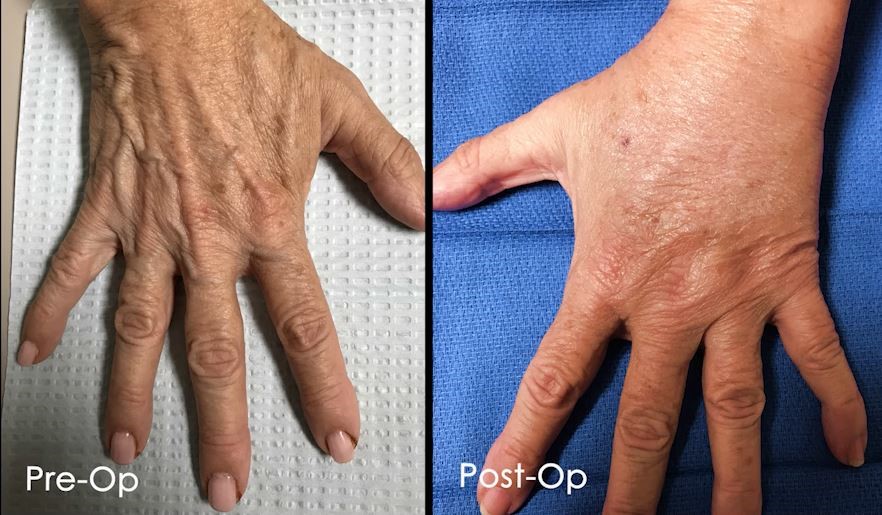 Don’t Let your Hands Betray Your Age!
