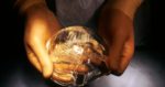 Are Breast Implants Permanent? Info on Longevity & Removal Process