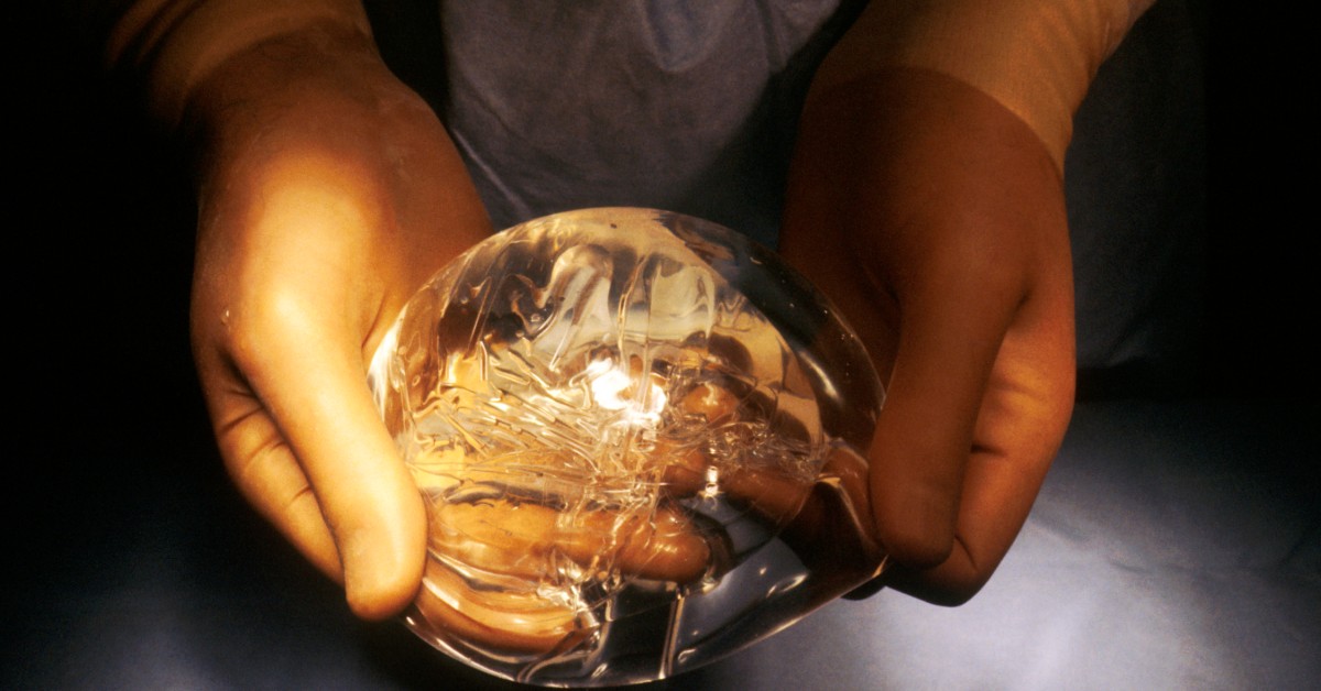 Are Breast Implants Permanent? Info on Longevity & Removal Process