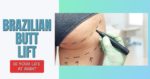Brazilian Butt Lift – Is Your Life at Risk?