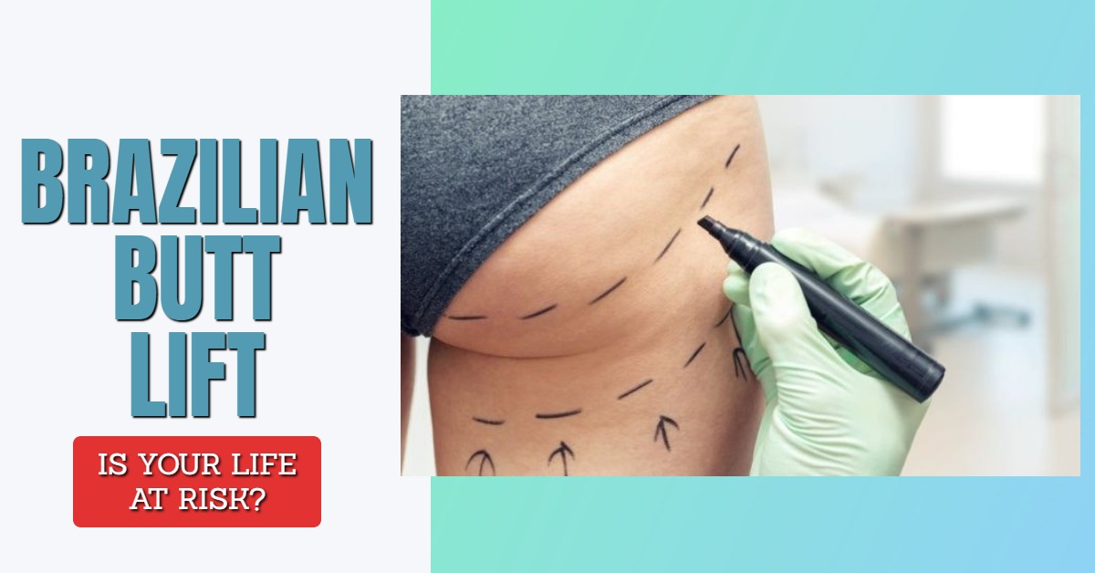 Brazilian Butt Lift – Is Your Life at Risk?