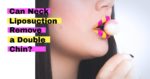 Is Double Chin Removal Possible With Neck Liposuction?