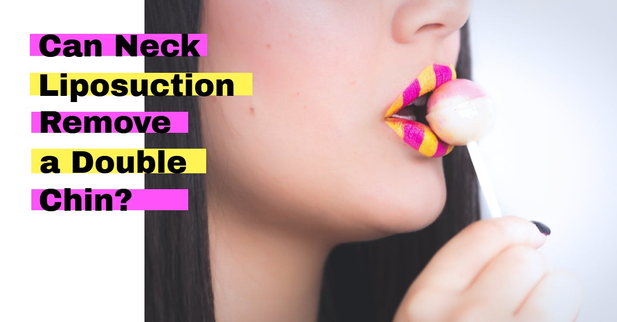 Is Double Chin Removal Possible With Neck Liposuction?