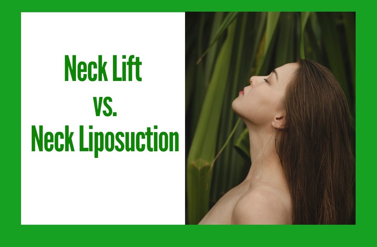 Neck Lipo vs. Neck Lift