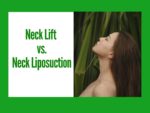 Neck Lipo vs. Neck Lift