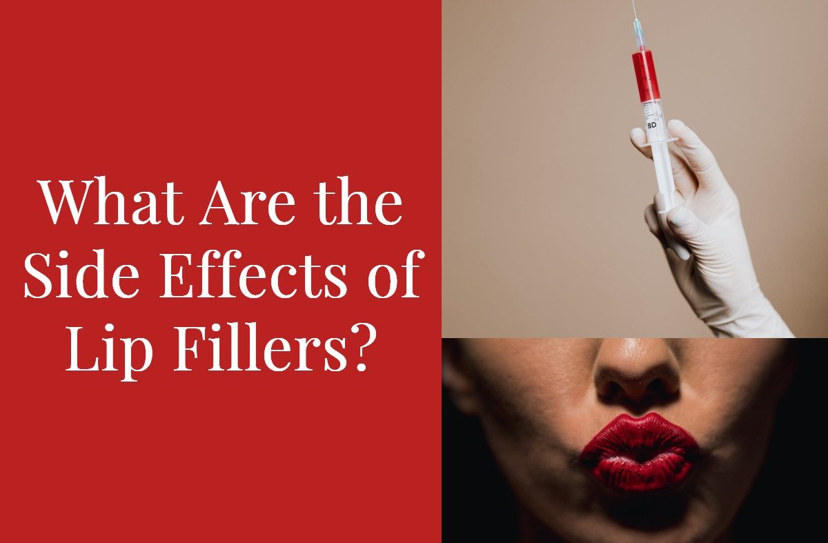 What Are the Side Effects of Lip Fillers?