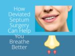 How Deviated Septum Surgery Can Help You Breathe Better