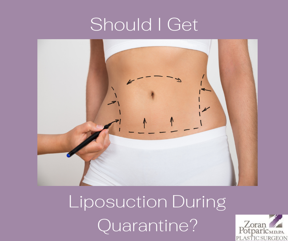 Should I Get Liposuction During Quarantine?