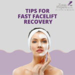 Tips for Fast Facelift Recovery