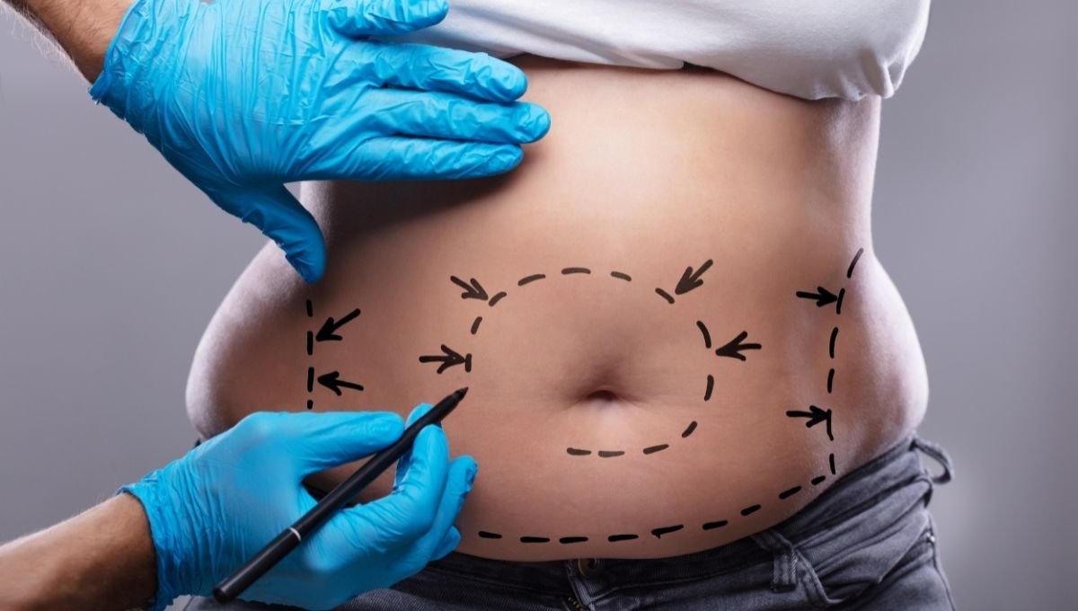 Liposuction Recovery Tips