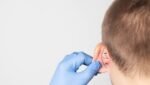 Otoplasty Recovery Time
