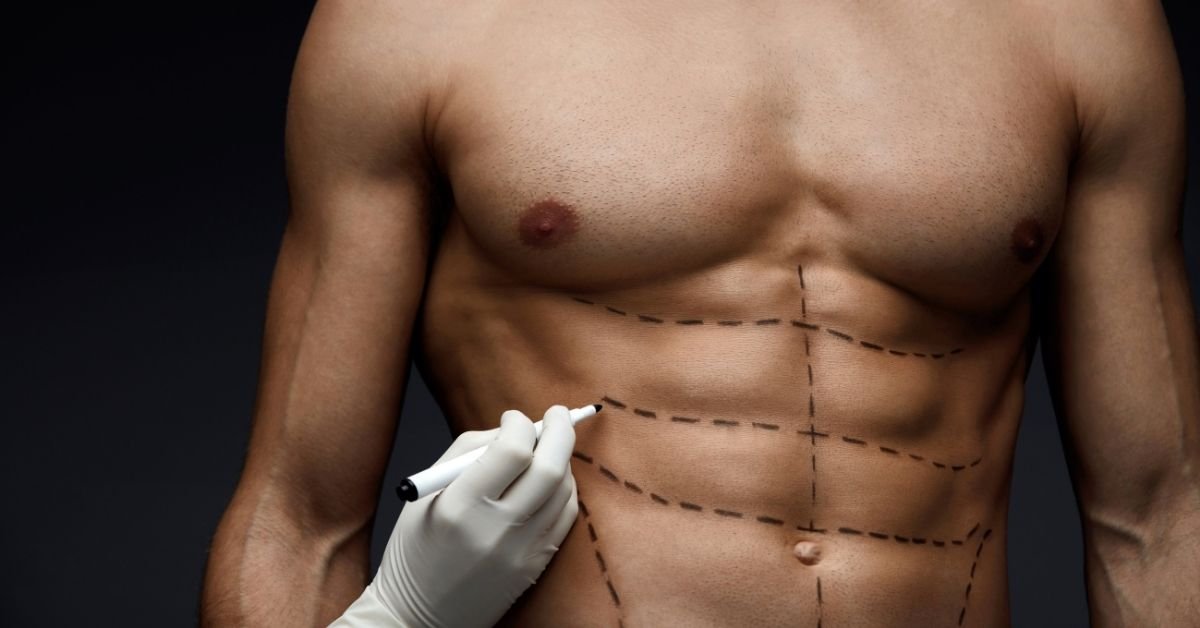 All You Need to Know About Male Body Contouring Procedures