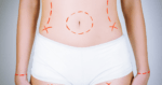 Analyzing Cosmetic Surgery Today