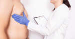 Gynecomastia Caused by Medication